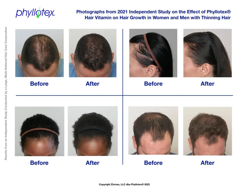 Cover page of the 2021 independent study on Phyllotex — before and after photos of women and men with thinning hair