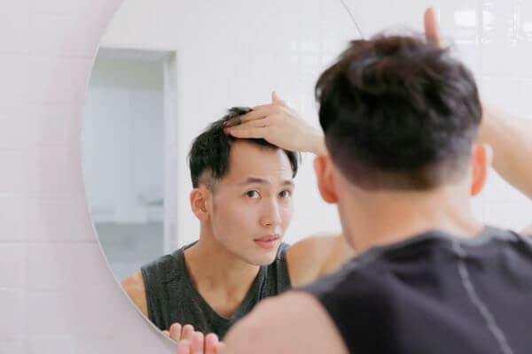 man worries about hair loss